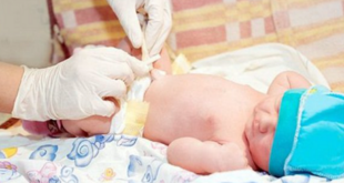 Chăm sóc bệnh nhân nhi trong giai đoạn hậu phẫu mổ thoát vị rốn