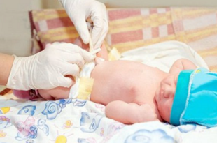 Chăm sóc bệnh nhân nhi trong giai đoạn hậu phẫu mổ thoát vị rốn