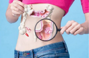 Đau hông trái do nhiều nguyên nhân gây ra