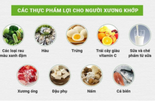 Các thực phẩm lợi cho người xương khớp